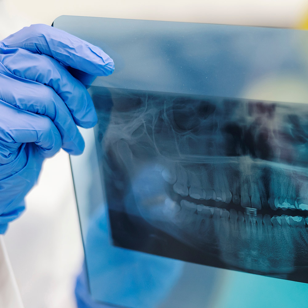 TAC Dental y Ortopantomografia